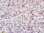 ZCWCC1 Antibody in Immunohistochemistry (Paraffin) (IHC (P))