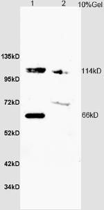 ZCWCC1 Antibody in Western Blot (WB)