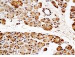 NT5C2 Antibody in Immunohistochemistry (Paraffin) (IHC (P))