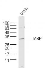 MBP Antibody in Western Blot (WB)