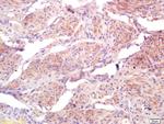 BRI3BP Antibody in Immunohistochemistry (Paraffin) (IHC (P))