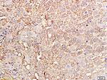 TIMP-1 Antibody in Immunohistochemistry (Paraffin) (IHC (P))