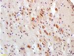 Tau protein Antibody in Immunohistochemistry (Paraffin) (IHC (P))