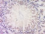 PIBF Antibody in Immunohistochemistry (Paraffin) (IHC (P))