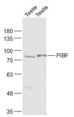 PIBF Antibody in Western Blot (WB)