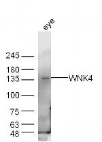 WNK4 Antibody in Western Blot (WB)