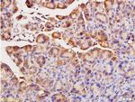 ACE Antibody in Immunohistochemistry (Paraffin) (IHC (P))