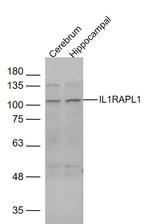 IL1RAPL1 Antibody in Western Blot (WB)