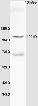Thyroid peroxidase Antibody in Western Blot (WB)