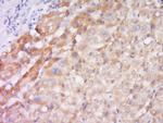 TSLP human Antibody in Immunohistochemistry (Paraffin) (IHC (P))