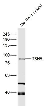 TSHR Antibody in Western Blot (WB)