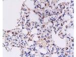 IFN gamma Antibody in Immunohistochemistry (Paraffin) (IHC (P))
