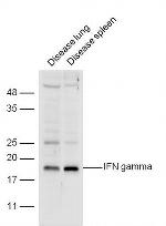 IFN gamma Antibody in Western Blot (WB)
