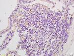 EphA2 Antibody in Immunohistochemistry (Paraffin) (IHC (P))