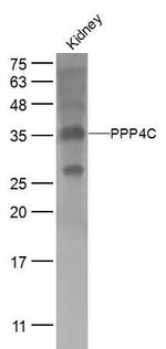 PPP4C Antibody in Western Blot (WB)