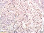 Dnmt3a Antibody in Immunohistochemistry (Paraffin) (IHC (P))