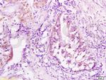 JNK1 + 3 Antibody in Immunohistochemistry (Paraffin) (IHC (P))