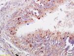 TBX2 Antibody in Immunohistochemistry (Paraffin) (IHC (P))