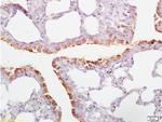 CD2AP Antibody in Immunohistochemistry (Paraffin) (IHC (P))