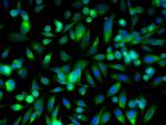 RAR Beta Antibody in Immunocytochemistry (ICC/IF)