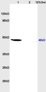 RAR Beta Antibody in Western Blot (WB)