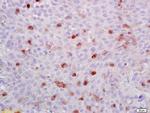 ATF1 Antibody in Immunohistochemistry (Paraffin) (IHC (P))