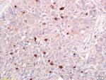 ATF2 Antibody in Immunohistochemistry (Paraffin) (IHC (P))