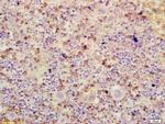 ATF3 Antibody in Immunohistochemistry (Paraffin) (IHC (P))