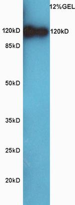 CD44 Antibody in Western Blot (WB)