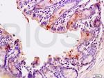 CD10 Antibody in Immunohistochemistry (Paraffin) (IHC (P))