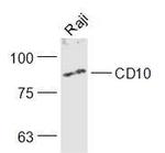 CD10 Antibody in Western Blot (WB)