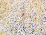 Matriptase Antibody in Immunohistochemistry (Paraffin) (IHC (P))