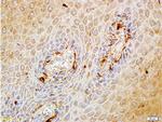 Matriptase Antibody in Immunohistochemistry (Paraffin) (IHC (P))