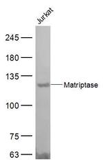 Matriptase Antibody in Western Blot (WB)