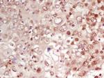CDK1 Antibody in Immunohistochemistry (Paraffin) (IHC (P))