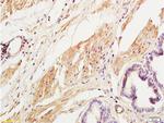 Collagen 3 Antibody in Immunohistochemistry (Paraffin) (IHC (P))