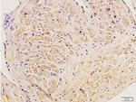 Collagen 3 Antibody in Immunohistochemistry (Paraffin) (IHC (P))