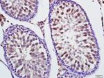 Mfn1 Antibody in Immunohistochemistry (Paraffin) (IHC (P))
