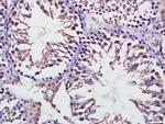 Mfn1 Antibody in Immunohistochemistry (Paraffin) (IHC (P))