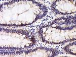 Integrin alpha 5 Antibody in Immunohistochemistry (Paraffin) (IHC (P))