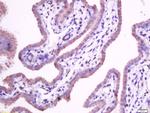 Integrin alpha 5 Antibody in Immunohistochemistry (Paraffin) (IHC (P))