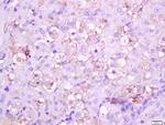 Integrin alpha 5 Antibody in Immunohistochemistry (Paraffin) (IHC (P))