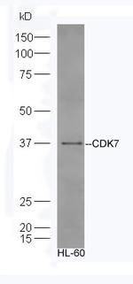 CDK7 Antibody in Western Blot (WB)