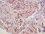 Cyclin B1 Antibody in Immunohistochemistry (Paraffin) (IHC (P))