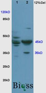 Cyclin E Antibody in Western Blot (WB)