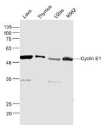 Cyclin E Antibody in Western Blot (WB)