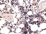 MMP-13 Antibody in Immunohistochemistry (Paraffin) (IHC (P))