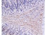 Collagen 1 Antibody in Immunohistochemistry (Paraffin) (IHC (P))