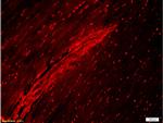 Collagen 1 Antibody in Immunohistochemistry (Paraffin) (IHC (P))