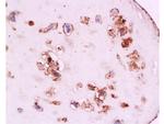 CD105 Antibody in Immunohistochemistry (Paraffin) (IHC (P))